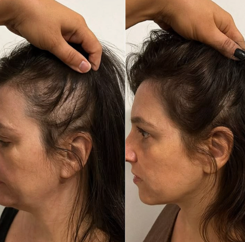 À 52 ans, mes cheveux sont revenus